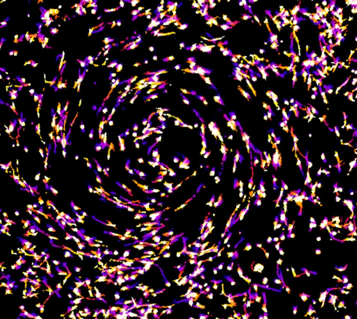 microscopic view of pink cancer cells