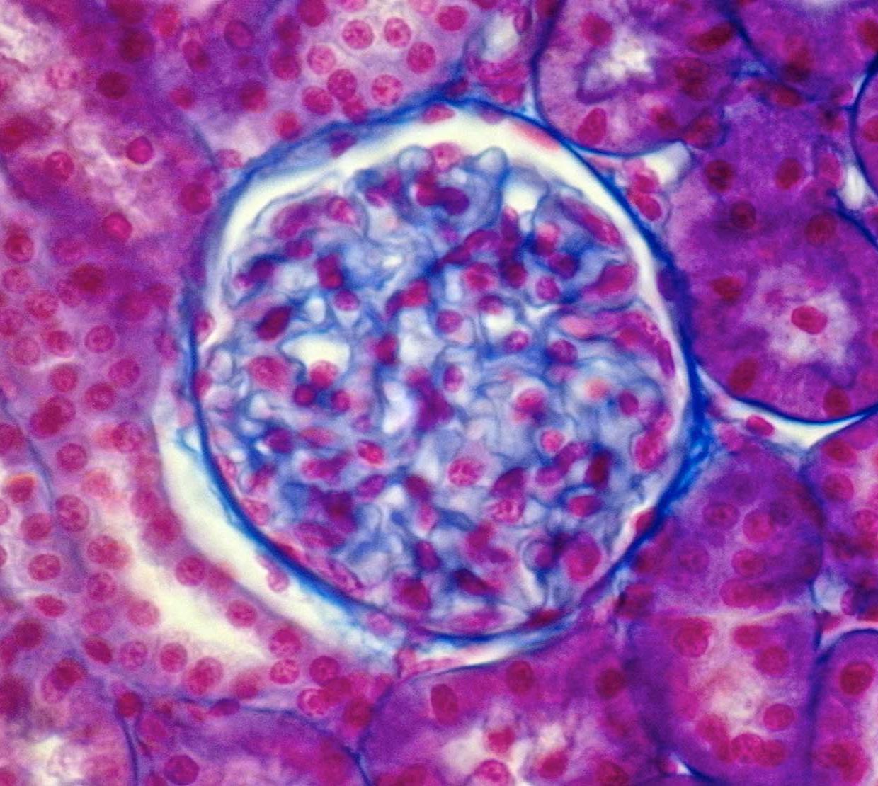 Microscopic photograph of kidney cells.