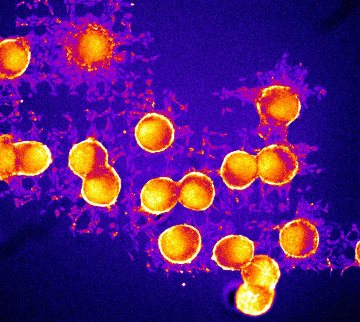 neuron spheroids on a chip designed to control the communication channels between the neuron cells. Color shows the firing activity of the cells.