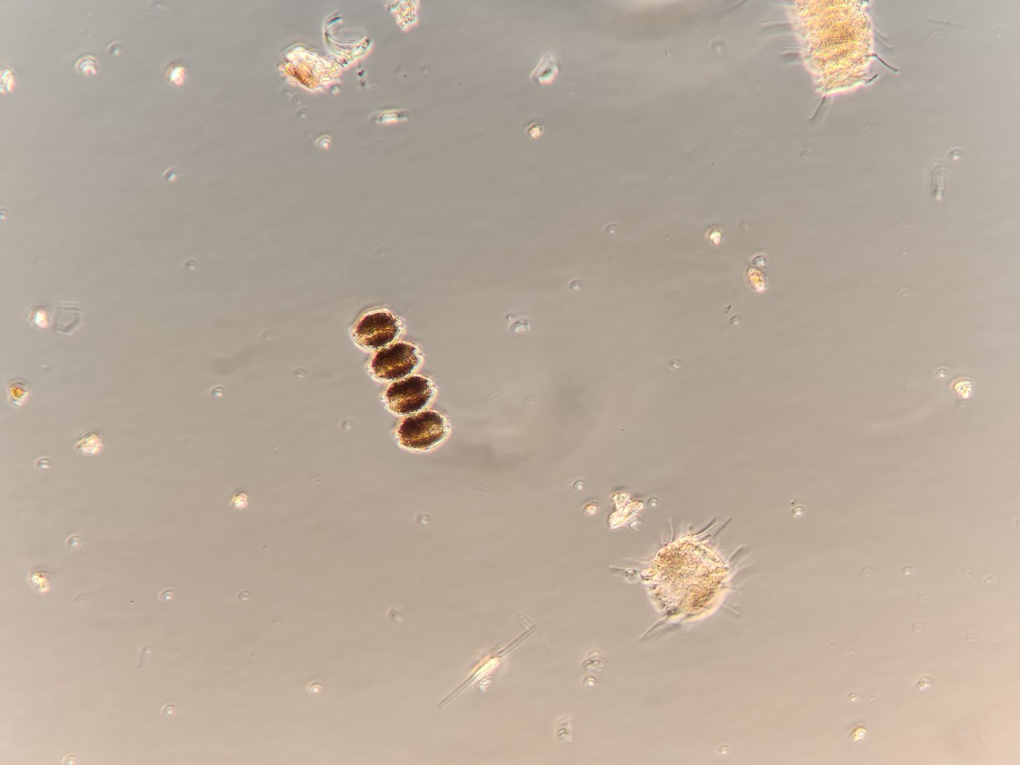A closeup of four brown cells that are attached in a chain. Under the microscope, this is the Alexandrium catenella 4-cell chain.