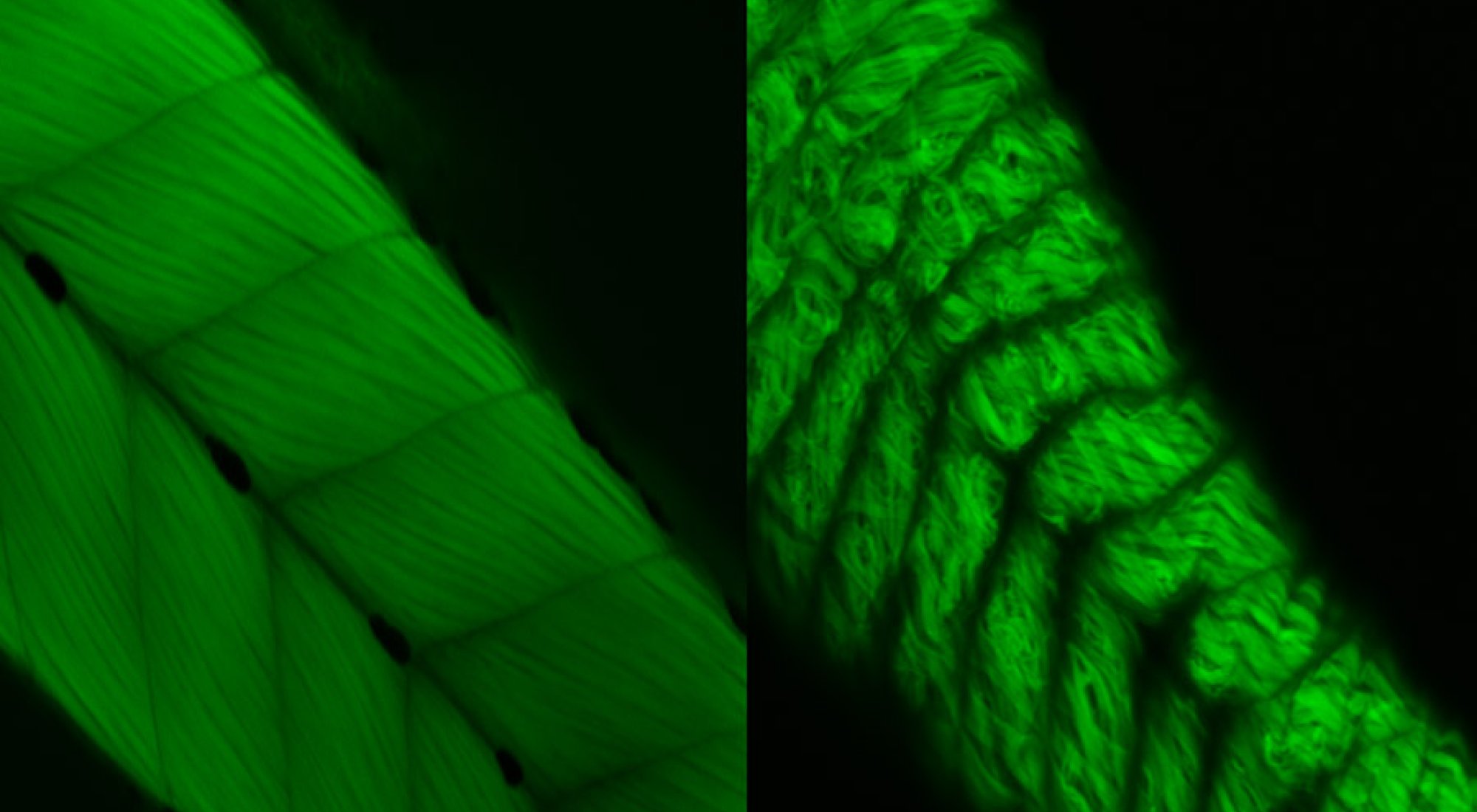 Fluorescence staining of zebrafish embryos showing skeletal muscle differences when Fer1l6 is introduced