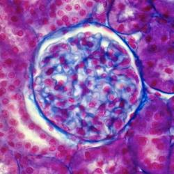 Microscopic photograph of kidney cells.