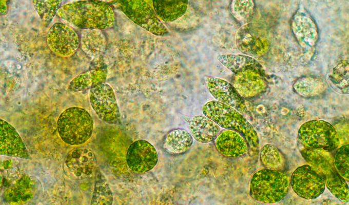 microscopic picture of green Eukaryotes
