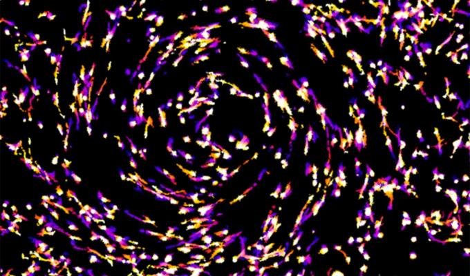 microscopic view of pink cancer cells