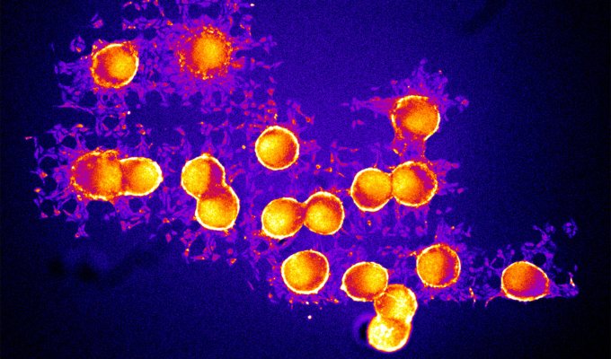 neuron spheroids on a chip designed to control the communication channels between the neuron cells. Color shows the firing activity of the cells.